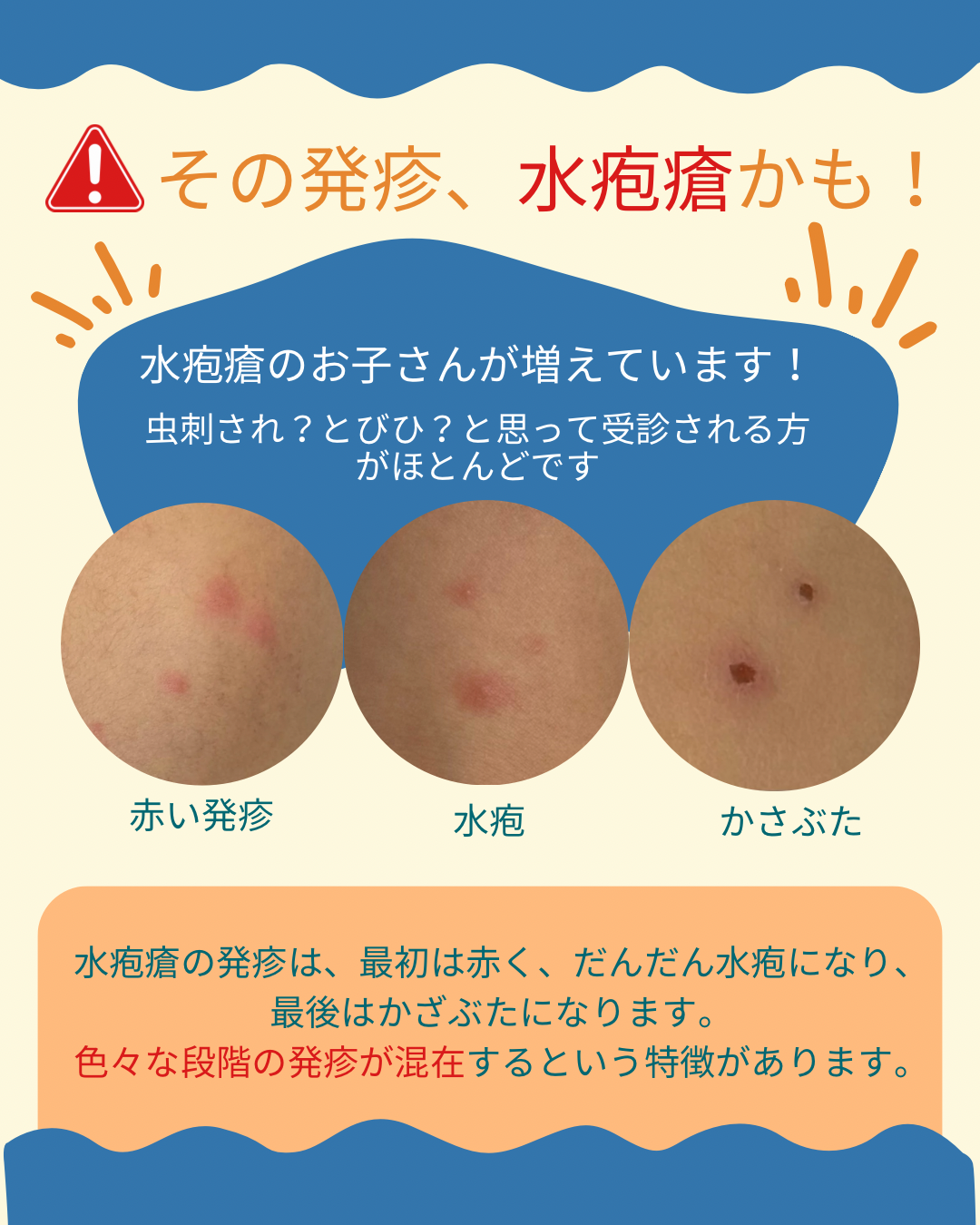 当時のメディア報道・掲載写真